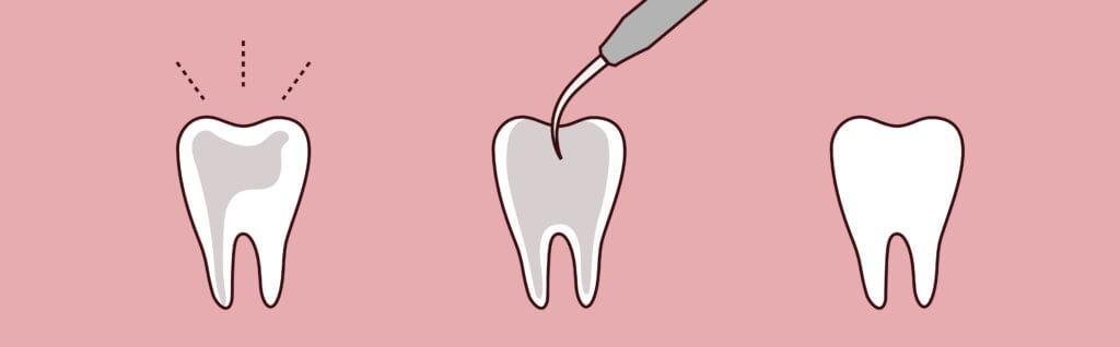 - Pure Gold Professionals in Dentistry - Redlands Dentist - Pure Gold Professionals in Dentistry - Redlands Dentist -