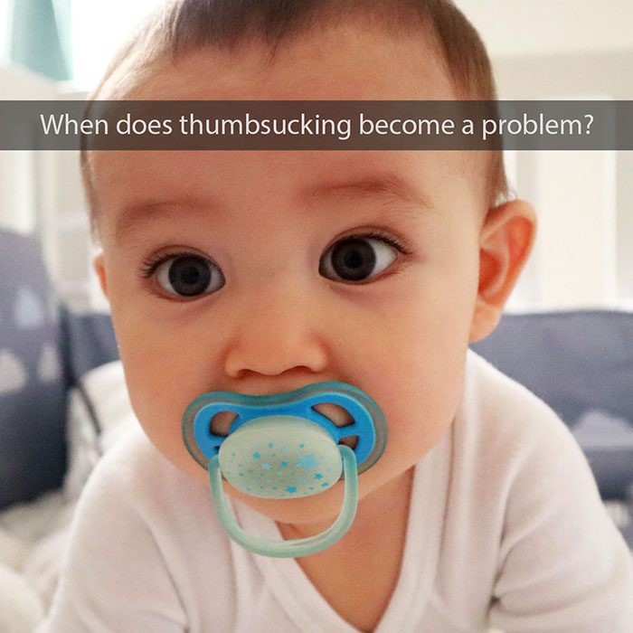 When Is Thumbsucking a Problem? - Pure Gold Professionals in Dentistry - Redlands Dentist - Pure Gold Professionals in Dentistry - Redlands Dentist -