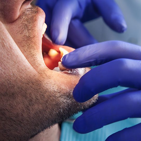 The Dentist's Tips for Maintaining a Healthy Smile for Life - Pure Gold Professionals in Dentistry - Redlands Dentist - dentist cleanings